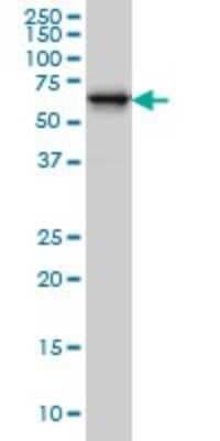 Western Blot: RTKN Antibody (2E5) [H00006242-M01]