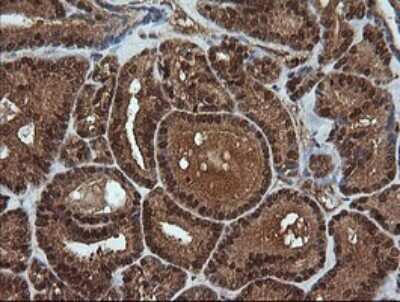 Immunohistochemistry: RTKN Antibody (OTI2E9) - Azide and BSA Free [NBP2-73950]