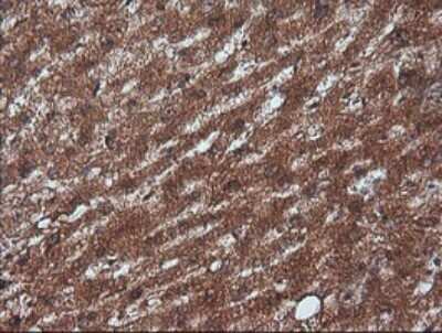 Immunohistochemistry: RTKN Antibody (OTI2E9) - Azide and BSA Free [NBP2-73950]