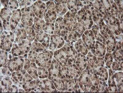 Immunohistochemistry: RTKN Antibody (OTI2E9) - Azide and BSA Free [NBP2-73950]
