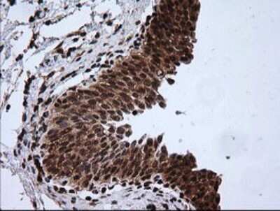 Immunohistochemistry-Paraffin: RTKN Antibody (OTI2E9) [NBP2-45966]