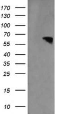 Western Blot: RTKN Antibody (OTI2E9) [NBP2-45966]
