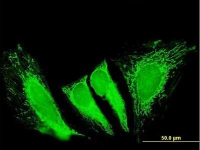 Immunocytochemistry/ Immunofluorescence: RTKN2 Antibody [H00219790-B01P]