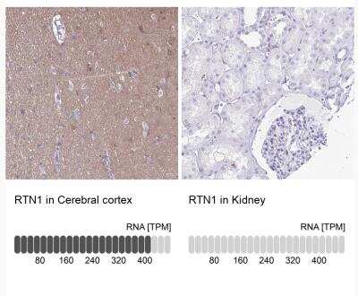Immunohistochemistry-Paraffin: RTN1-A/NSP Antibody [NBP2-38527]