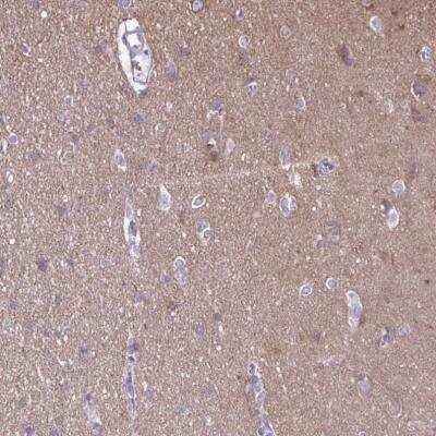 Immunohistochemistry-Paraffin: RTN1-A/NSP Antibody [NBP2-38527]