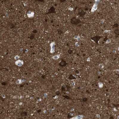 Immunohistochemistry-Paraffin: RTN3 Antibody [NBP1-88870]