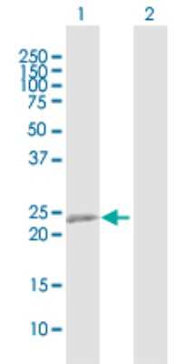 Western Blot: RTN3 Antibody [H00010313-B01P]