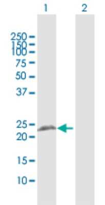 Western Blot: RTN3 Antibody [H00010313-D01P]