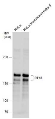 Western Blot: RTN3 Antibody [NBP3-12988]