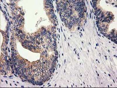 Immunohistochemistry-Paraffin: RTN4IP1 Antibody (OTI3B2) [NBP2-00478]