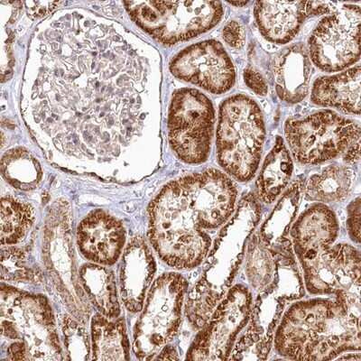 Immunohistochemistry-Paraffin: RTN4IP1 Antibody [NBP1-82568]