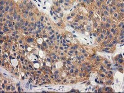 Immunohistochemistry: RTN4IP1 Antibody (OTI3B2) - Azide and BSA Free [NBP2-73952]