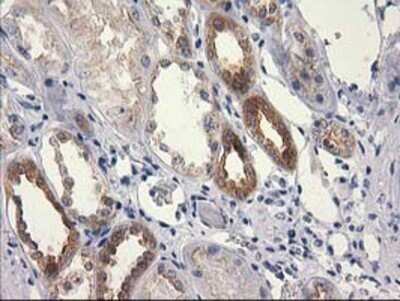 Immunohistochemistry: RTN4IP1 Antibody (OTI3B2) - Azide and BSA Free [NBP2-73952]