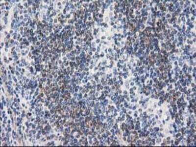 Immunohistochemistry: RTN4IP1 Antibody (OTI3B2) - Azide and BSA Free [NBP2-73952]