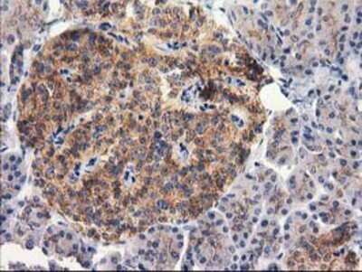 Immunohistochemistry: RTN4IP1 Antibody (OTI3B2) - Azide and BSA Free [NBP2-73952]