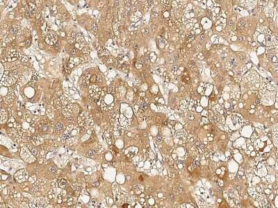 Immunohistochemistry-Paraffin: RTVP-1/GLIPR1 Antibody [NBP2-99206]