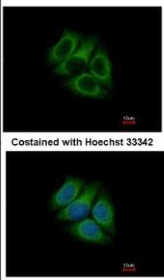 Immunocytochemistry/ Immunofluorescence: RUFY1 Antibody [NBP2-20242]