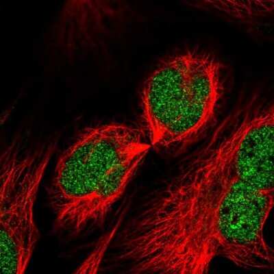 Immunocytochemistry/ Immunofluorescence: RUFY2 Antibody [NBP1-90448]