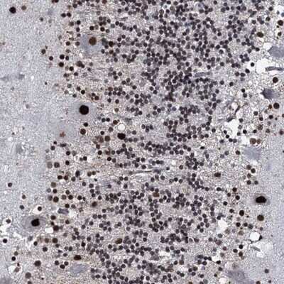 Immunohistochemistry-Paraffin: RUFY2 Antibody [NBP1-90448]