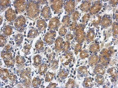 Immunohistochemistry-Paraffin: RUNDC1 Antibody [NBP2-20243]