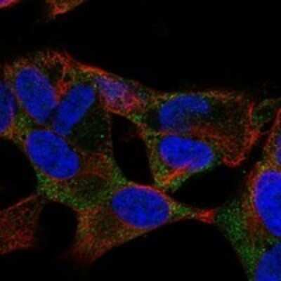Immunocytochemistry/ Immunofluorescence: RUNDC3B Antibody [NBP3-17306]
