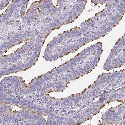 Immunohistochemistry-Paraffin: RUNDC3B Antibody [NBP2-31654]