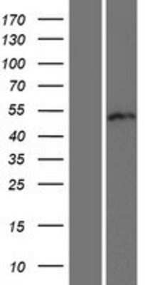 Western Blot: RUNDC3B Overexpression Lysate [NBP2-05679]