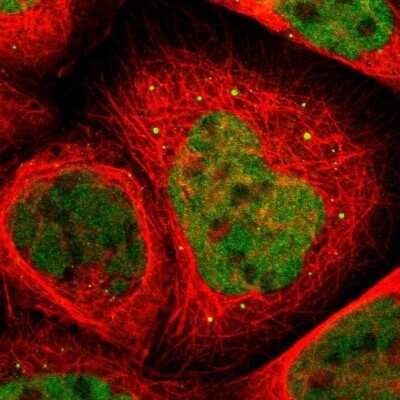 Immunocytochemistry/ Immunofluorescence: RUNX1/CBFA2 Antibody [NBP1-89105]
