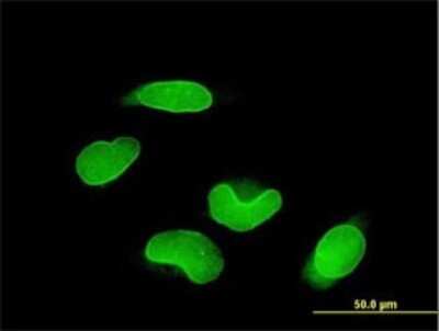 Immunocytochemistry/ Immunofluorescence: RUNX1T1/ETO Antibody (5A12) [H00000862-M01]
