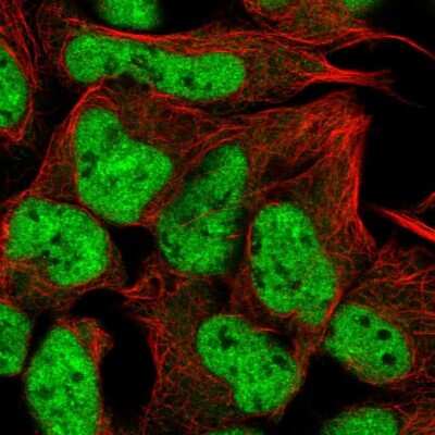 Immunocytochemistry/ Immunofluorescence: RUNX1T1/ETO Antibody [NBP2-55747]