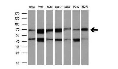 Western Blot: RUNX1T1/ETO Antibody (OTI1H1)Azide and BSA Free [NBP2-73956]