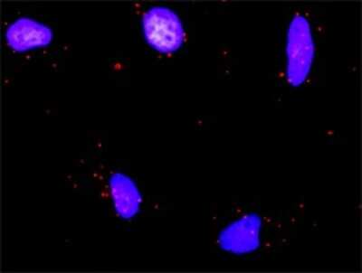 Proximity Ligation Assay: RUNX1T1/ETO Antibody [H00000862-D01P]