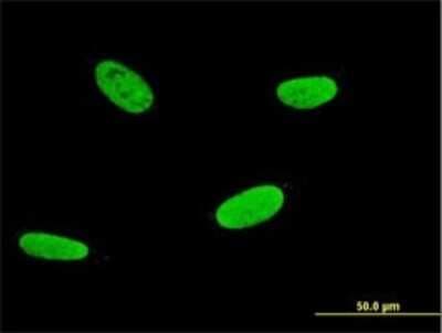 Immunocytochemistry/ Immunofluorescence: RUNX2/CBFA1 Antibody (1D8) [H00000860-M01]