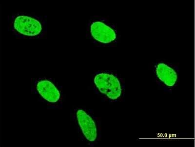 Immunocytochemistry/ Immunofluorescence: RUNX2/CBFA1 Antibody (3F5) [H00000860-M06]