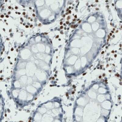 Immunohistochemistry-Paraffin: RUNX2/CBFA1 Antibody (CL0232) [NBP2-52887]