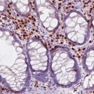 Immunohistochemistry-Paraffin: RUNX2/CBFA1 Antibody (CL0235) [NBP2-52888]