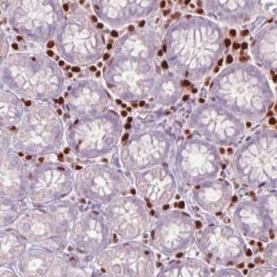 Immunohistochemistry-Paraffin: RUNX2/CBFA1 Antibody (CL0235) [NBP2-52888]