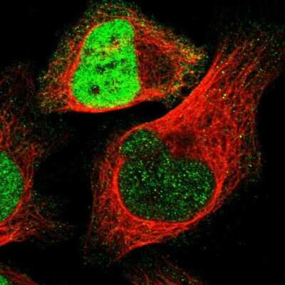 Immunocytochemistry/ Immunofluorescence: RUNX2/CBFA1 Antibody [NBP1-89104]