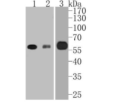 Western Blot: RUNX2/CBFA1 Antibody (SD208-0) [NBP2-67777]