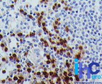 Immunohistochemistry-Paraffin: RUNX3/CBFA3 Antibody (2B10E8) - BSA Free [NBP2-22391]