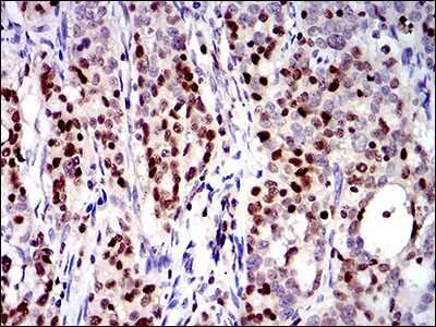 Immunohistochemistry: RUNX3/CBFA3 Antibody (2B3) - BSA Free [NBP2-37455]