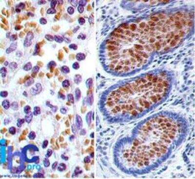 Immunohistochemistry-Paraffin: RUNX3/CBFA3 Antibody (2B9G4) [NBP2-22390]