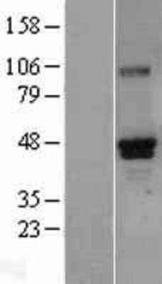 Western Blot: RUNX3/CBFA3 Overexpression Lysate [NBL1-15629]