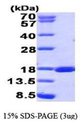 SDS-PAGE: Recombinant Human RUNX3/CBFA3 His Protein [NBP1-44462]