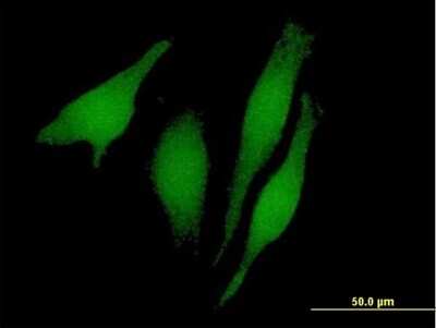 Immunocytochemistry/ Immunofluorescence: RUSC1 Antibody [H00023623-B01P]