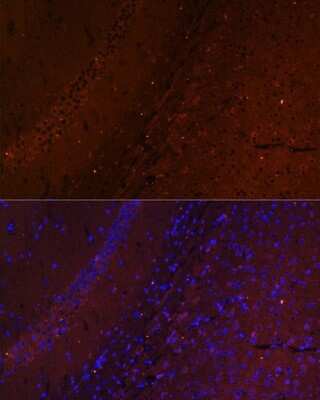 Immunohistochemistry: RUSC1 Antibody - Azide and BSA Free [NBP2-93950]