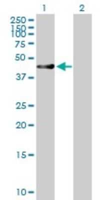 Western Blot: RUSC1 Antibody [H00023623-B01P]