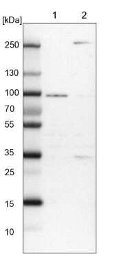 Western Blot: RUSC1 Antibody [NBP1-81005]