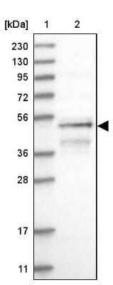 Western Blot: RUSC1 Antibody [NBP1-81006]