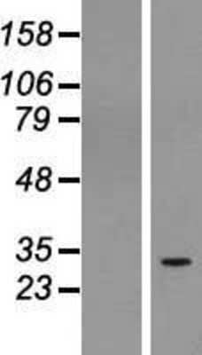 Western Blot: RUSC1 antisense RNA 1 Overexpression Lysate [NBL1-08289]